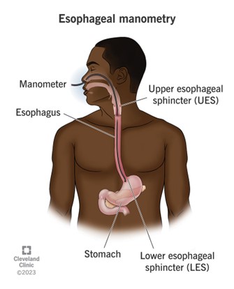 Esophageal Manometry Oesophageal Manometry